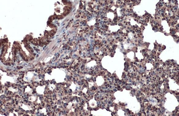 ERK2 Antibody in Immunohistochemistry (Paraffin) (IHC (P))