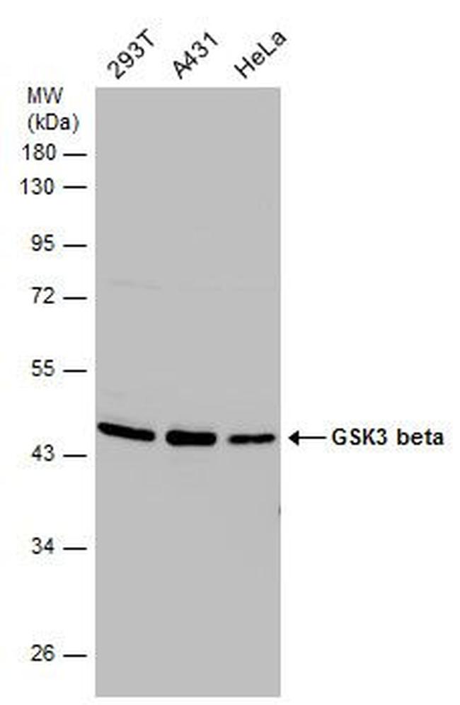 GSK3B Antibody in Western Blot (WB)