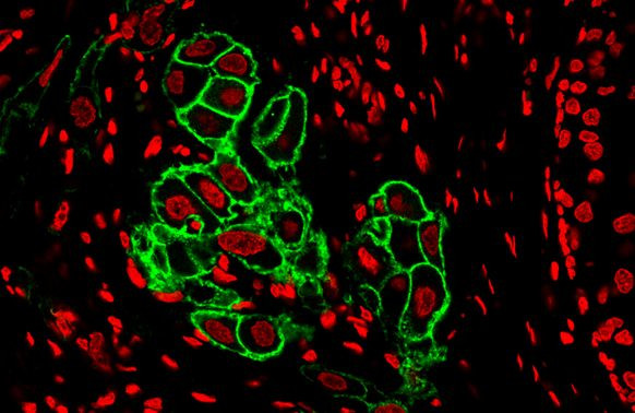 ErbB2 (HER-2) Antibody in Immunohistochemistry (Paraffin) (IHC (P))