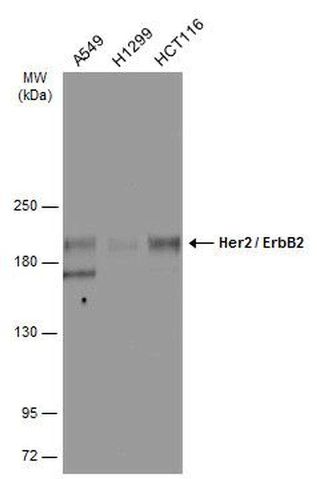 ErbB2 (HER-2) Antibody in Western Blot (WB)