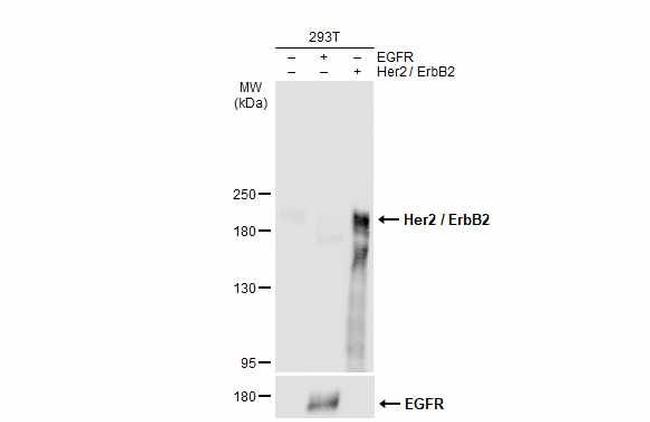 ErbB2 (HER-2) Antibody in Western Blot (WB)