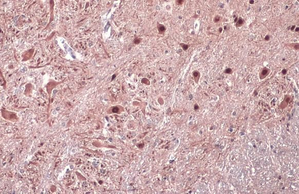 ISL2 Antibody in Immunohistochemistry (Paraffin) (IHC (P))