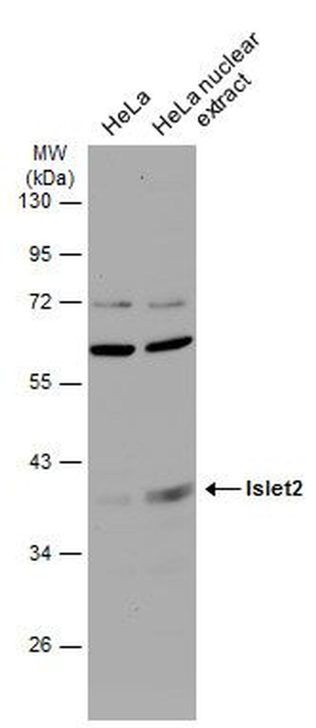 ISL2 Antibody in Western Blot (WB)