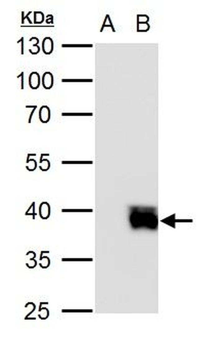 ISL2 Antibody in Western Blot (WB)