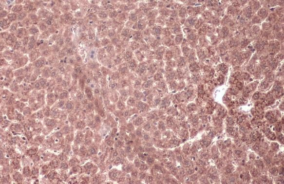 MEK1 Antibody in Immunohistochemistry (Paraffin) (IHC (P))