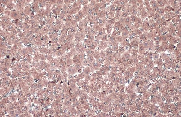 MEK1 Antibody in Immunohistochemistry (Paraffin) (IHC (P))