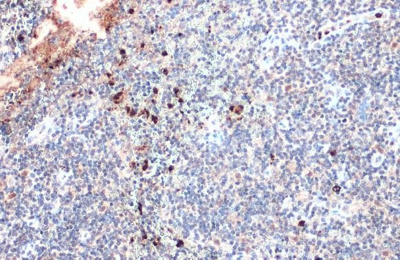 Myeloperoxidase Antibody in Immunohistochemistry (Paraffin) (IHC (P))