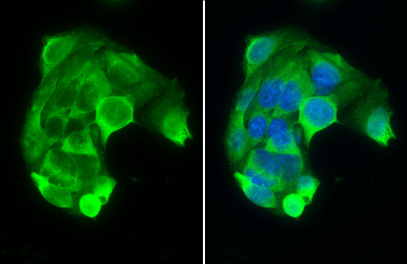 PAH Antibody in Immunocytochemistry (ICC/IF)