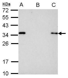 S-peptide Epitope Tag Antibody in Immunoprecipitation (IP)