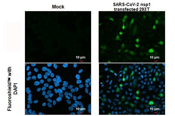 SARS-CoV-2 NSP1 Antibody in Immunocytochemistry (ICC/IF)