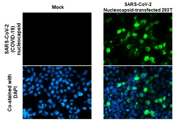 SARS/SARS-CoV-2 Nucleocapsid Antibody in Immunocytochemistry (ICC/IF)