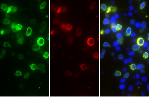 SARS/SARS-CoV-2 Nucleocapsid Antibody in Immunohistochemistry (Paraffin) (IHC (P))