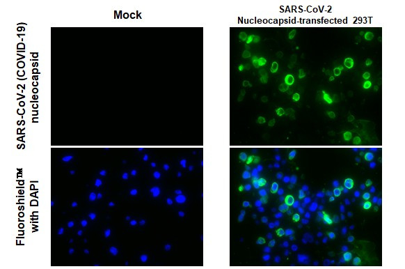 SARS/SARS-CoV-2 Nucleocapsid Antibody in Immunohistochemistry (Paraffin) (IHC (P))
