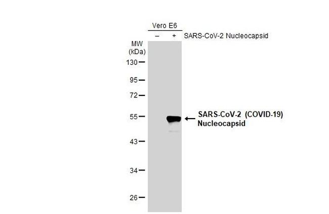 SARS/SARS-CoV-2 Nucleocapsid Antibody in Western Blot (WB)