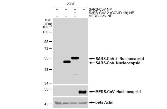 SARS/SARS-CoV-2 Nucleocapsid Antibody in Western Blot (WB)