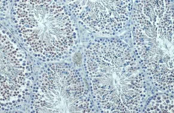 SIRT1 Antibody in Immunohistochemistry (Paraffin) (IHC (P))