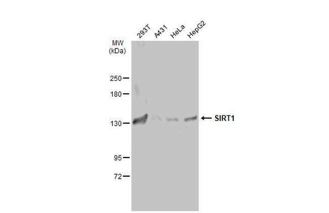 SIRT1 Antibody in Western Blot (WB)