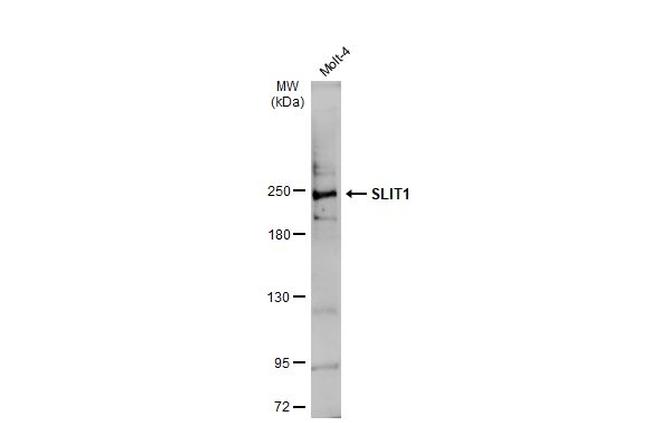 SLIT1 Antibody in Western Blot (WB)