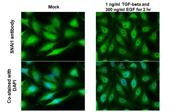 SNAIL Antibody in Immunocytochemistry (ICC/IF)