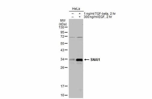 SNAIL Antibody in Western Blot (WB)