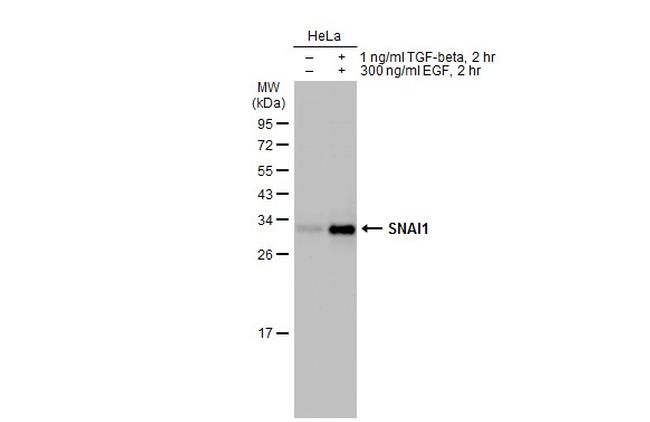 SNAIL Antibody in Western Blot (WB)