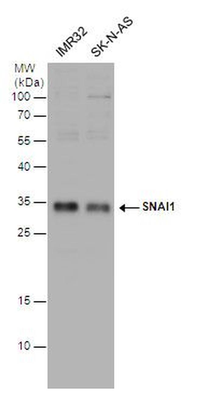 SNAIL Antibody in Western Blot (WB)