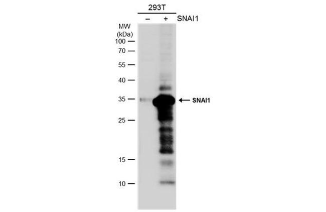 SNAIL Antibody in Western Blot (WB)