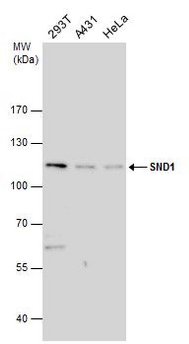 SND1 Antibody in Western Blot (WB)