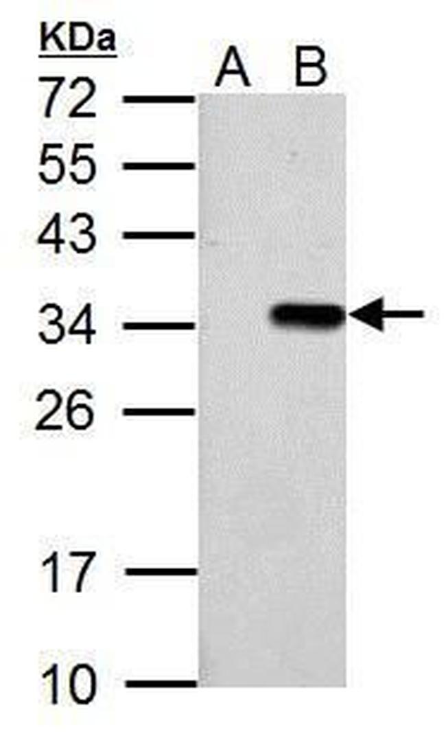 T7 Tag Antibody in Western Blot (WB)