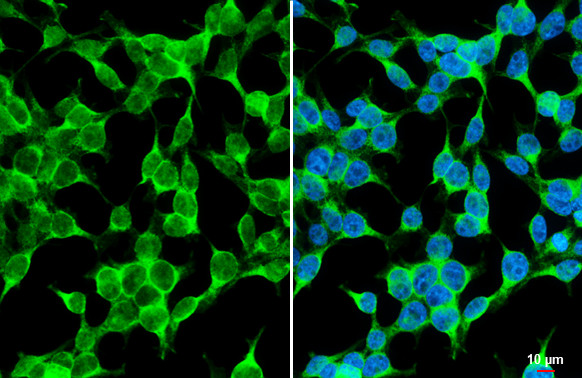 TAK1 Antibody in Immunocytochemistry (ICC/IF)