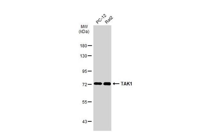 TAK1 Antibody in Western Blot (WB)