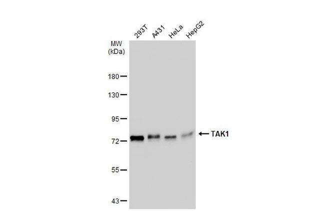 TAK1 Antibody in Western Blot (WB)