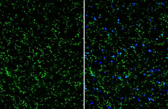 TMEM119 Antibody in Immunohistochemistry (Frozen) (IHC (F))