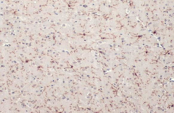 TMEM119 Antibody in Immunohistochemistry (Paraffin) (IHC (P))