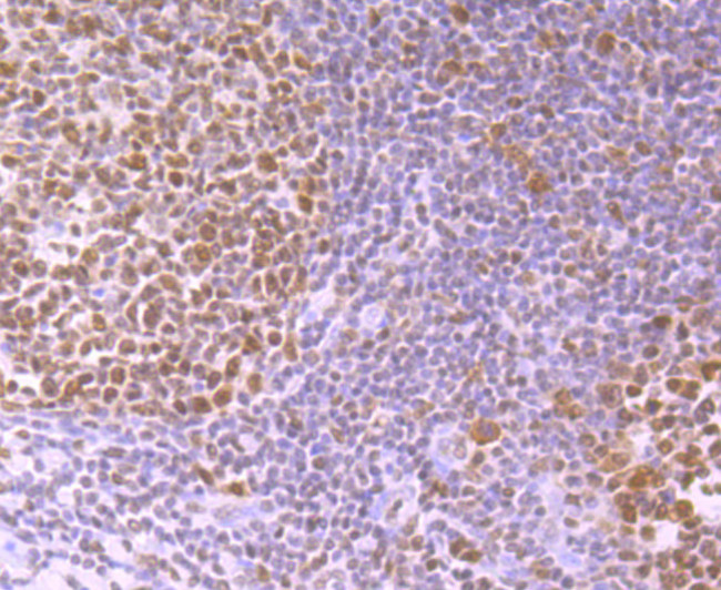 SNAIL Antibody in Immunohistochemistry (Paraffin) (IHC (P))