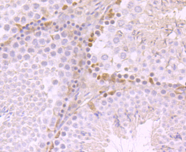 SNAIL Antibody in Immunohistochemistry (Paraffin) (IHC (P))