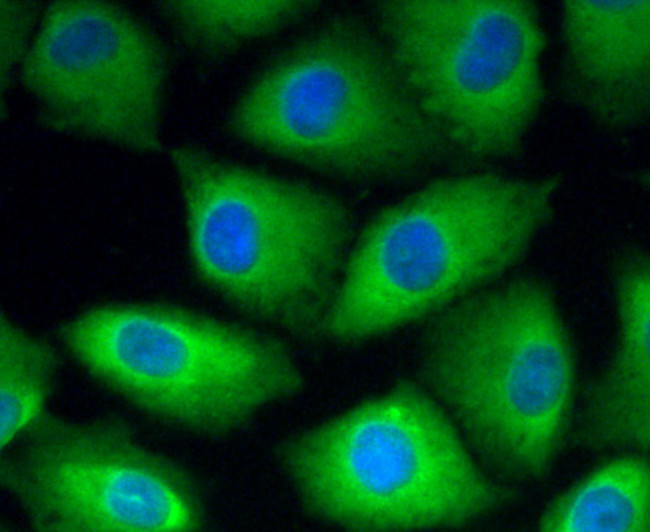 ROBO1 Antibody in Immunocytochemistry (ICC/IF)