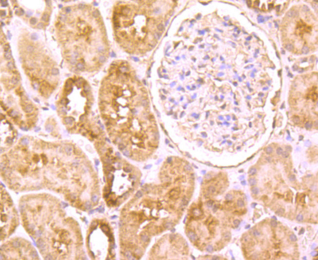 ROBO1 Antibody in Immunohistochemistry (Paraffin) (IHC (P))