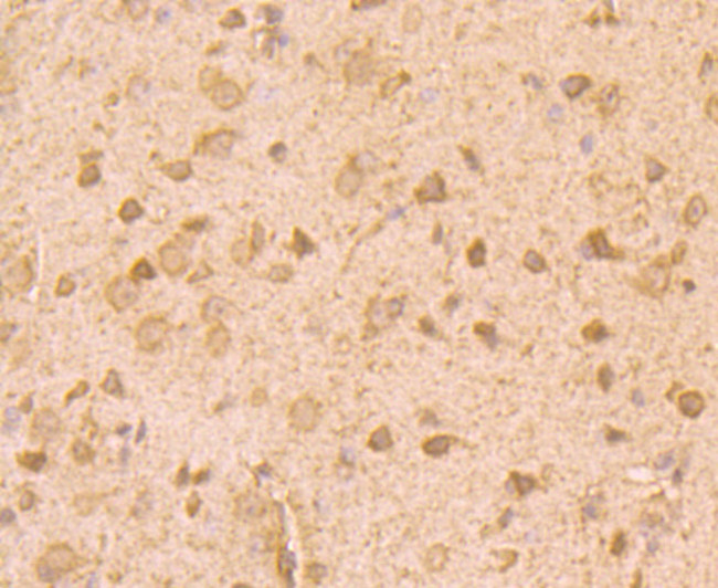 ROBO1 Antibody in Immunohistochemistry (Paraffin) (IHC (P))