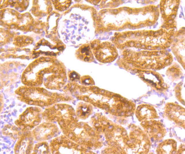 ROBO1 Antibody in Immunohistochemistry (Paraffin) (IHC (P))