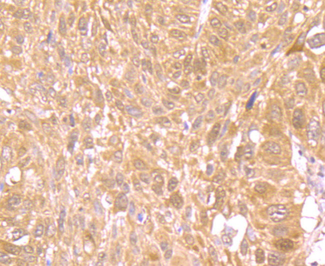 Nrf2 Antibody in Immunohistochemistry (Paraffin) (IHC (P))