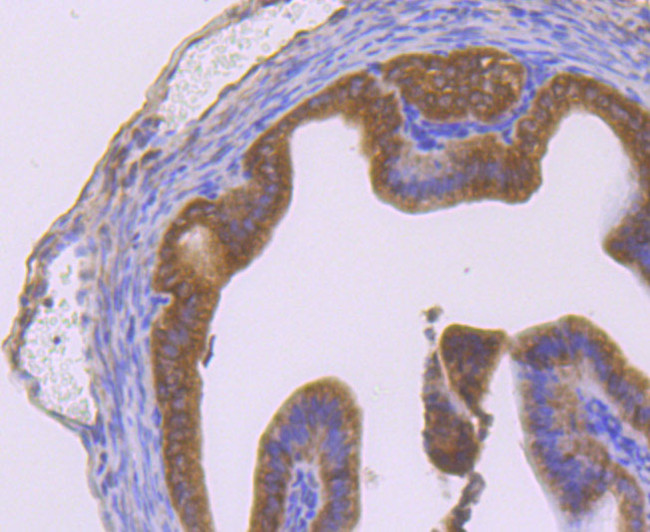 Nrf2 Antibody in Immunohistochemistry (Paraffin) (IHC (P))