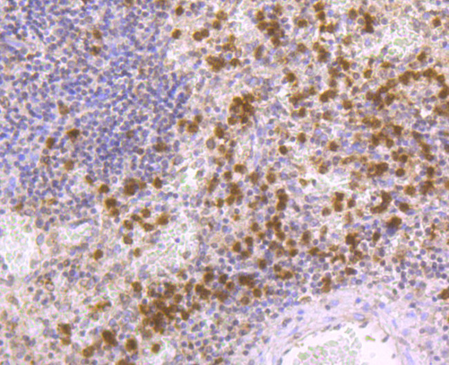 Nrf2 Antibody in Immunohistochemistry (Paraffin) (IHC (P))