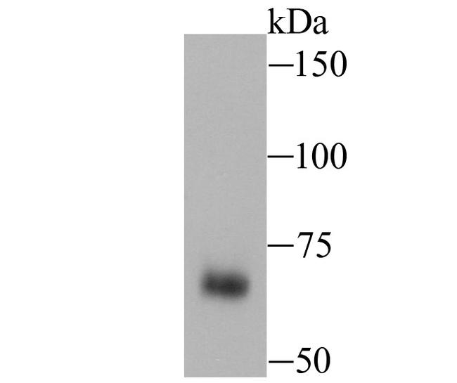 Nrf2 Antibody in Western Blot (WB)