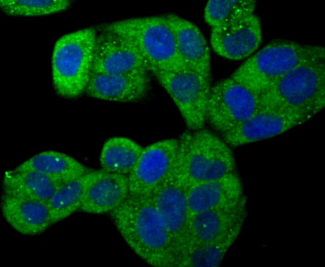 ROCK2 Antibody in Immunocytochemistry (ICC/IF)