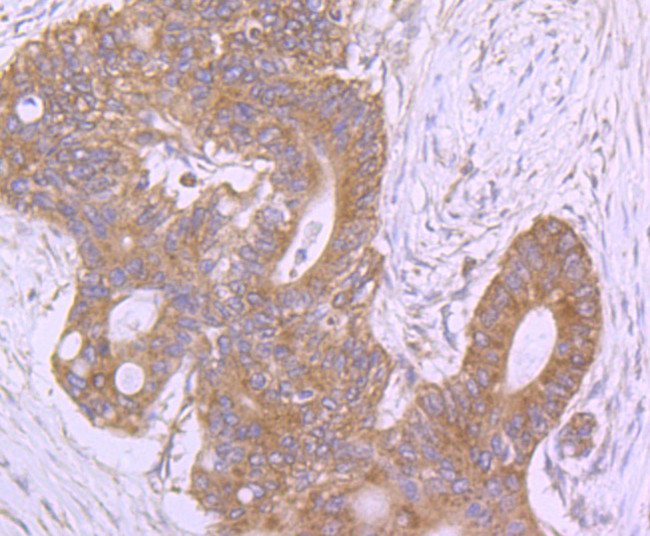 ROCK2 Antibody in Immunohistochemistry (Paraffin) (IHC (P))