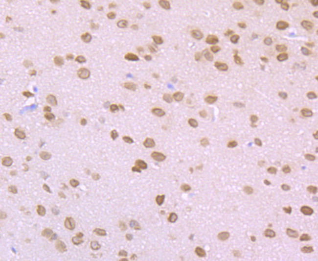 ROCK2 Antibody in Immunohistochemistry (Paraffin) (IHC (P))