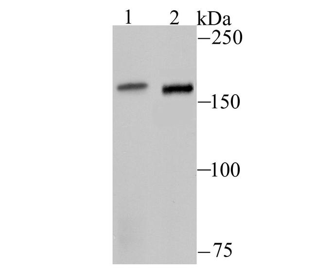 ROCK2 Antibody in Western Blot (WB)