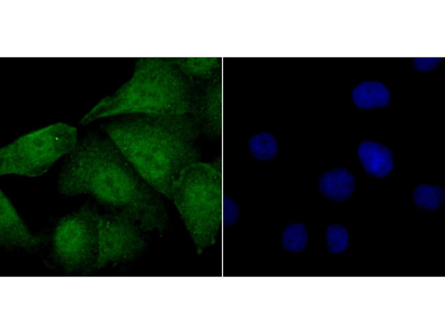 FOXM1 Antibody in Immunocytochemistry (ICC/IF)