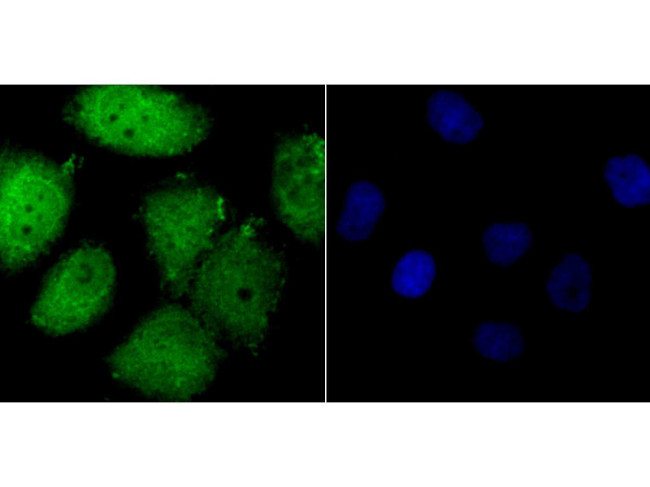 FOXM1 Antibody in Immunocytochemistry (ICC/IF)